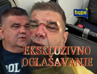 ПРВО ЈАВУВАЊЕ НА САША МИРКОВИЌ ОД БОЛНИЦА! НАПАДНАТ КУКАВИЧКИ ОД ПОЗАДИ, ПА НА ПОД ПОДЛО ШУТИРАН ВО ГЛАВА