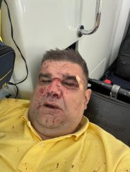 ОБИД ЗА УБИСТВО НА САША МИРКОВИЌ! Кукавички потег на Велибор Поповиќ Поп!